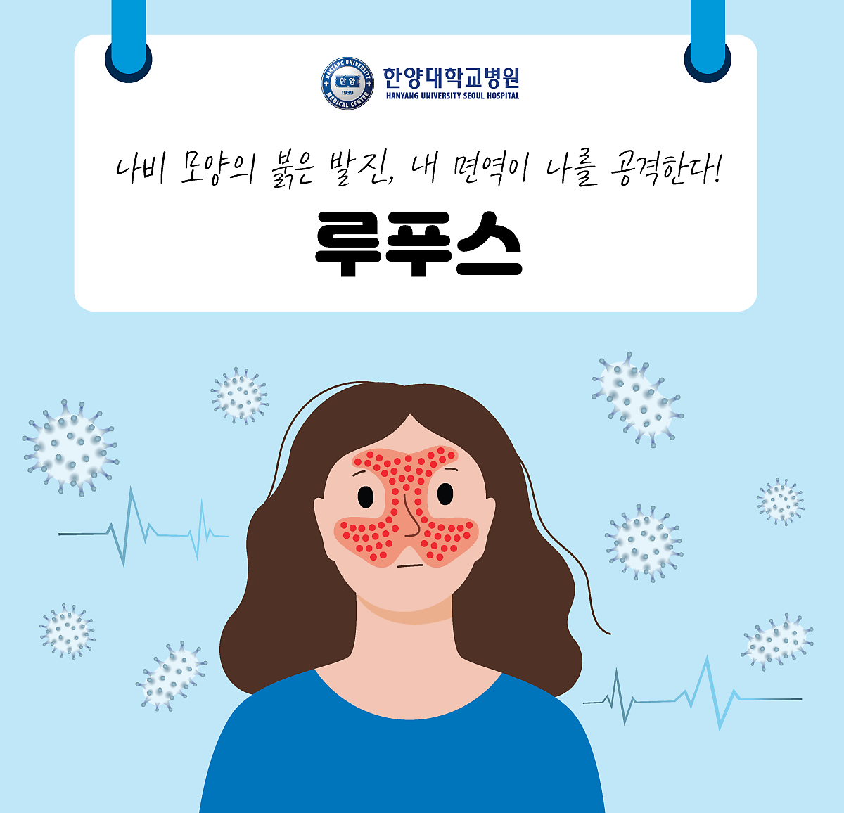 나비 모양의 붉은 발진, 내 면역이 나를 공격한다! '루푸스'